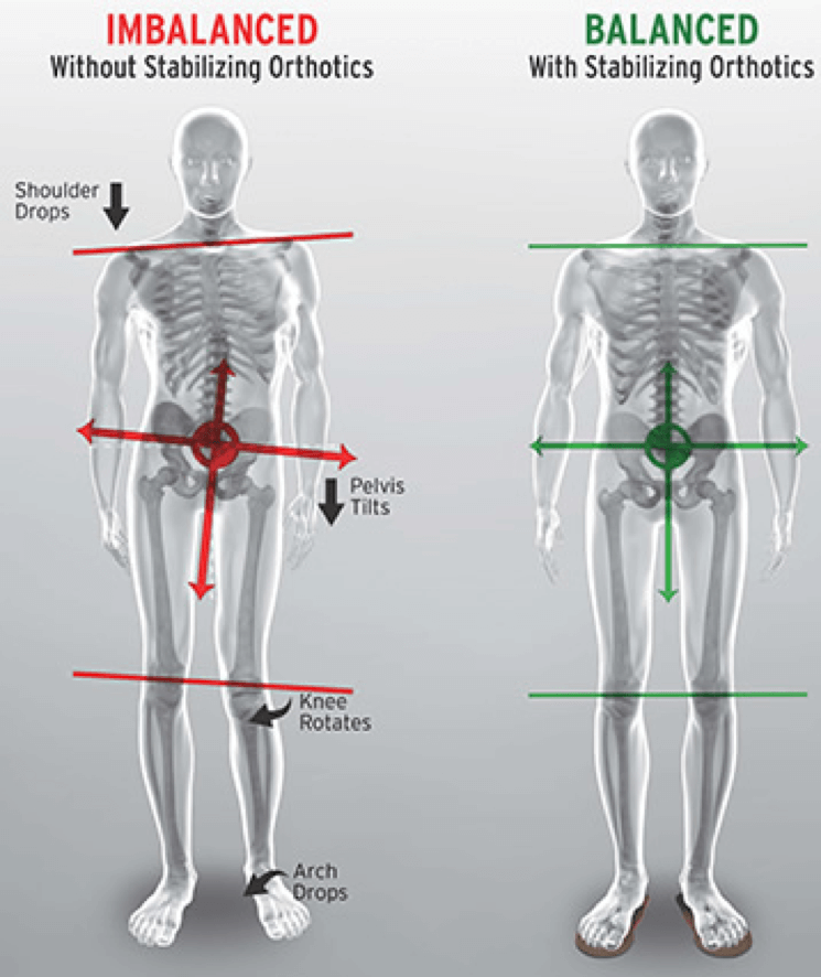 Common Foot Problems and How to treat? | ACC