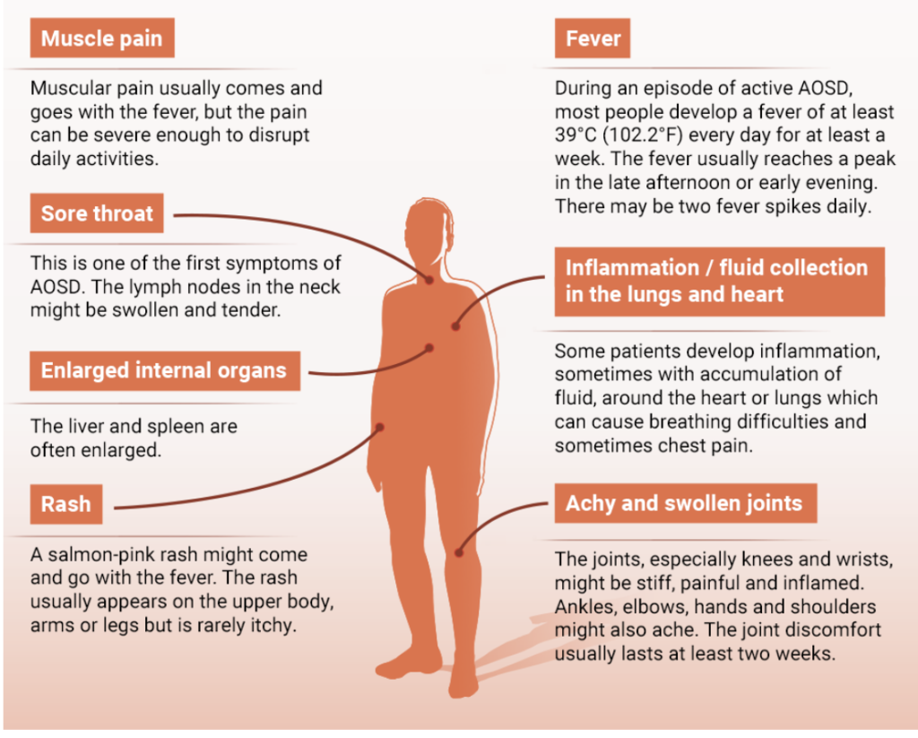 Bệnh Still người lớn, Adult-onset Still’s disease (AOSD) - Phòng Khám