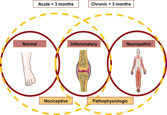 Chronic neuropathic pain is more than a perception: Systems and methods for  an integral characterization - ScienceDirect