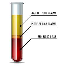 Platelet-rich Plasma Therapy | Spartanburg Regional