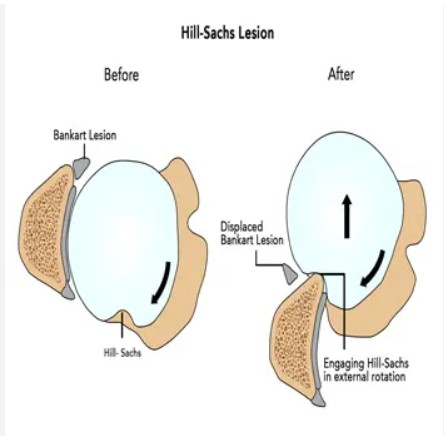Giải phẫu chi tiết khớp vai