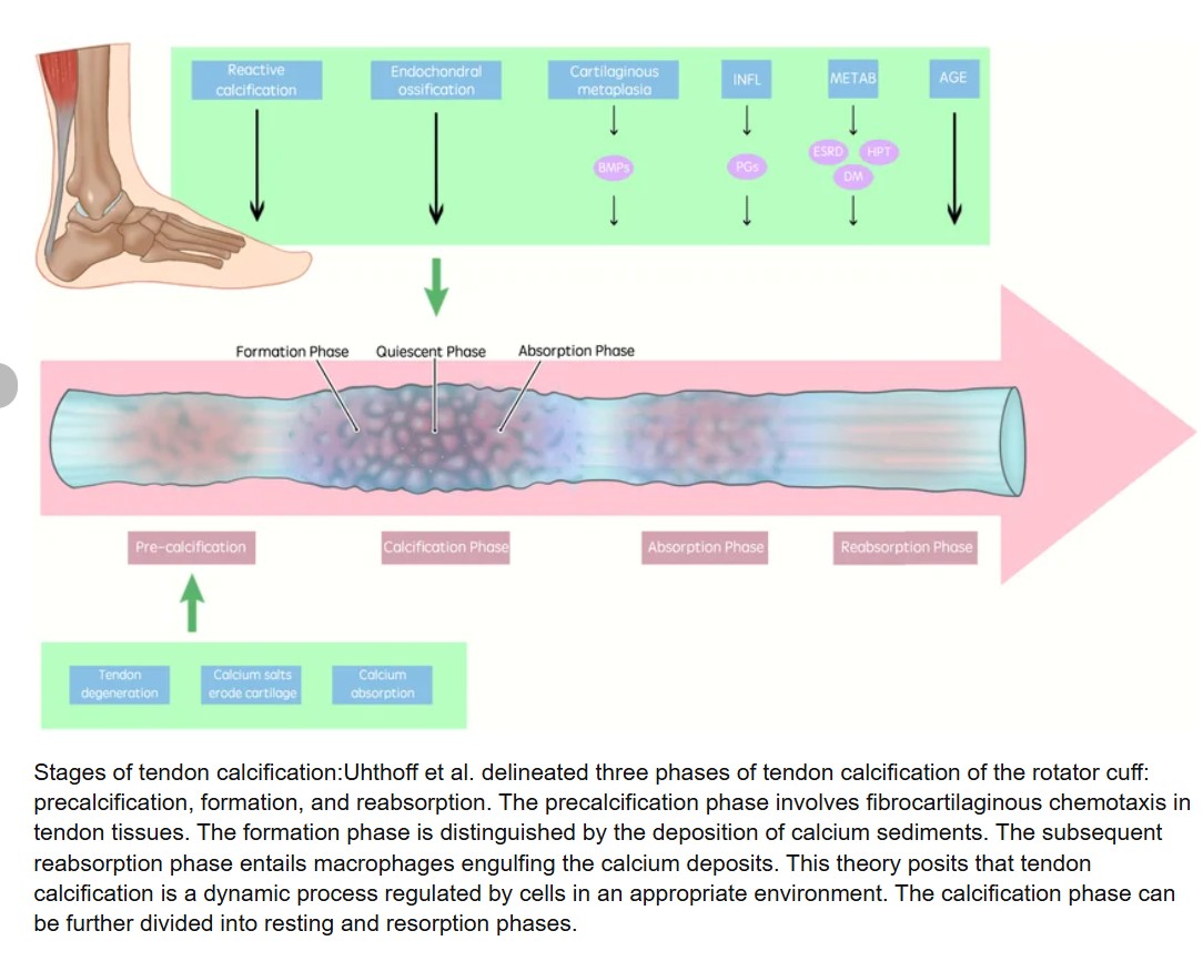 Các giai đoạn vôi hóa theo Uhthoff