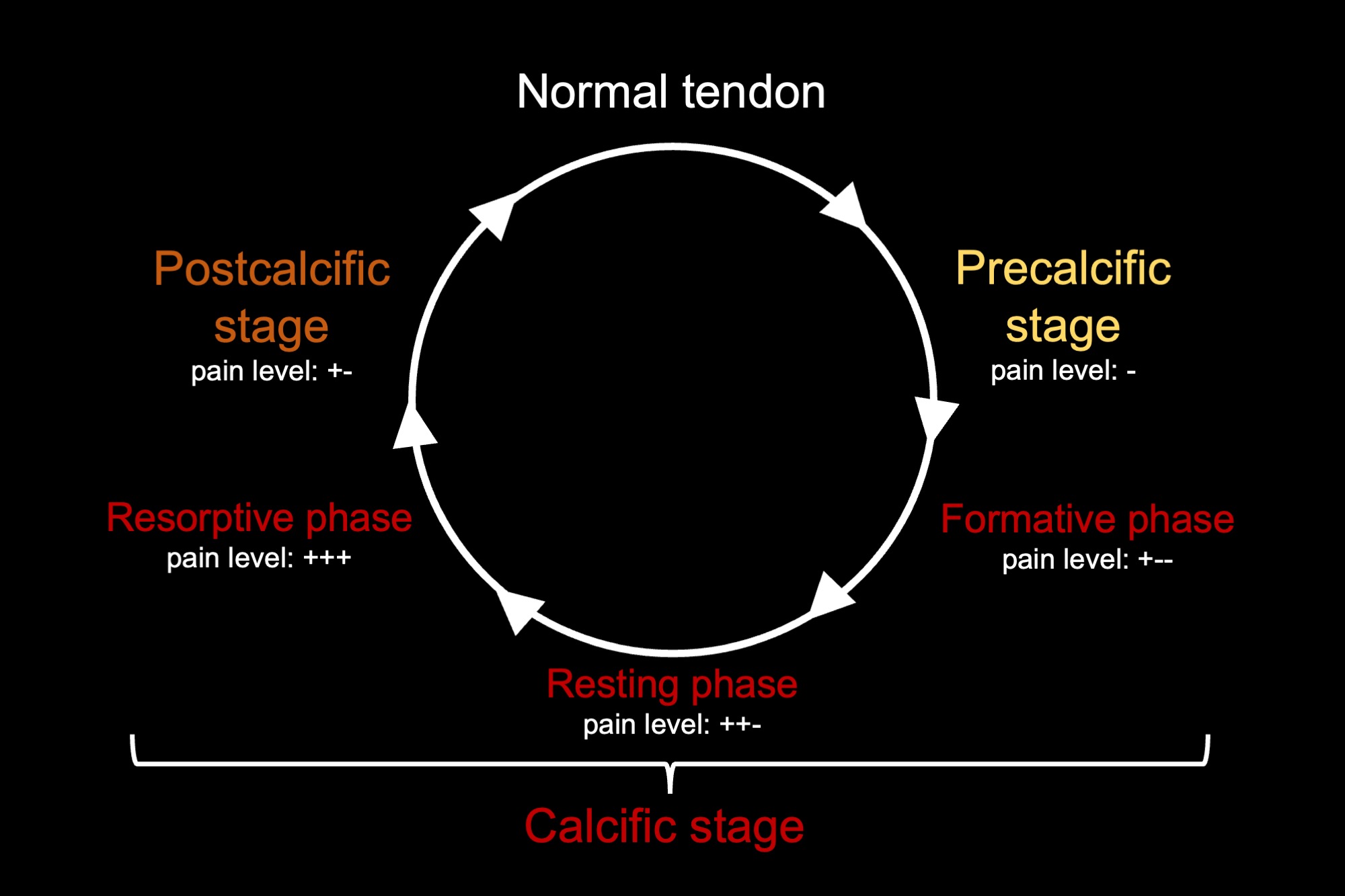 Sơ đồ sinh lý bệnh RCCT theo Uhthoff